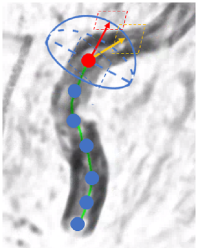 Paper: Simultaneous Intracranial Artery Tracing and Segmentation from Magnetic Resonance Angiography by Joint Optimization from Multiplanar Reformation